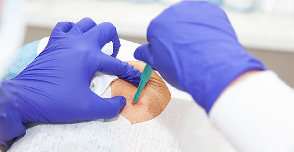 Test Veterinaria Biopsia Cutanea